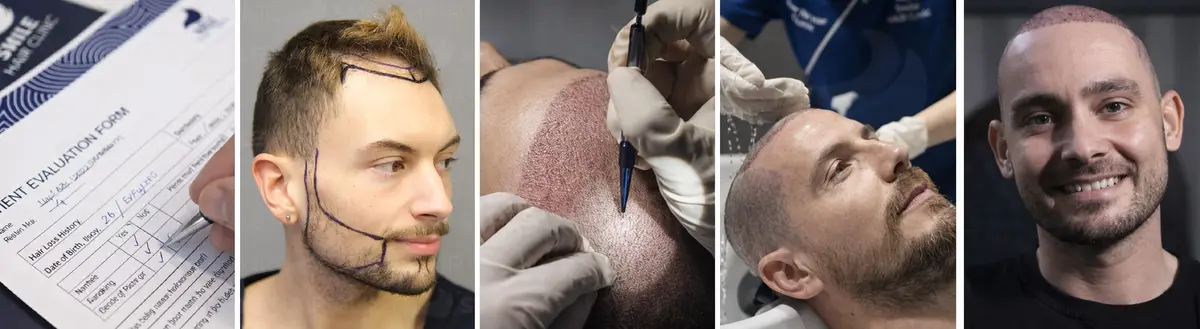 smile-hair-clinic-journey-banner