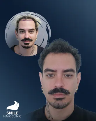 video Before - After 3