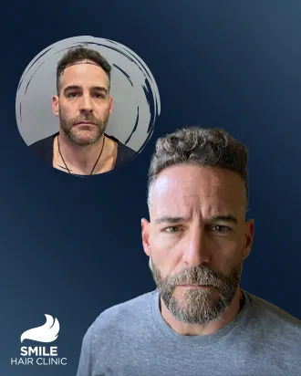 video Before - After 4