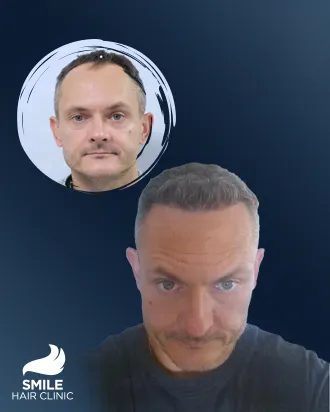 video Before - After 1